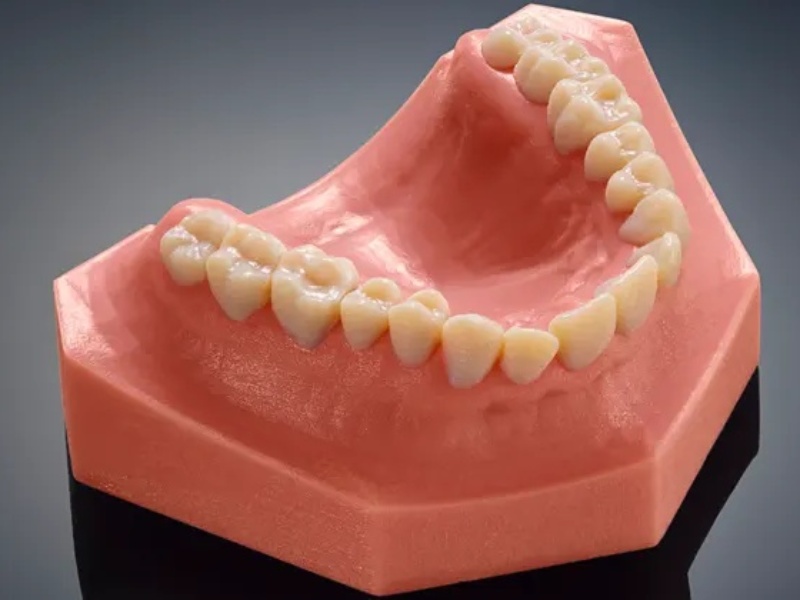 3D-printed-tooth-009